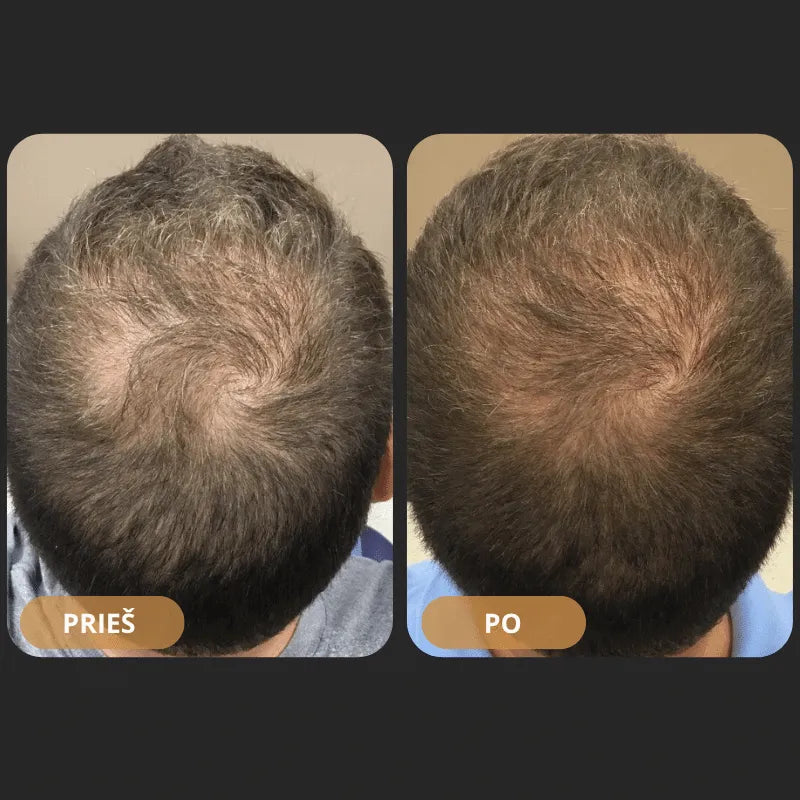 „Orylo™ RootBoost“ plaukų regeneracinis šampūnas