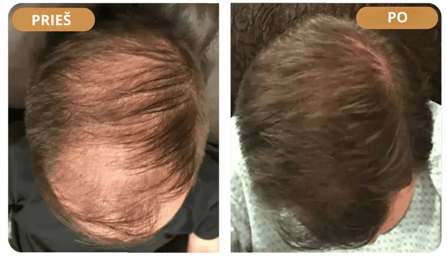 „Orylo™ RootBoost“ plaukų regeneracinis šampūnas