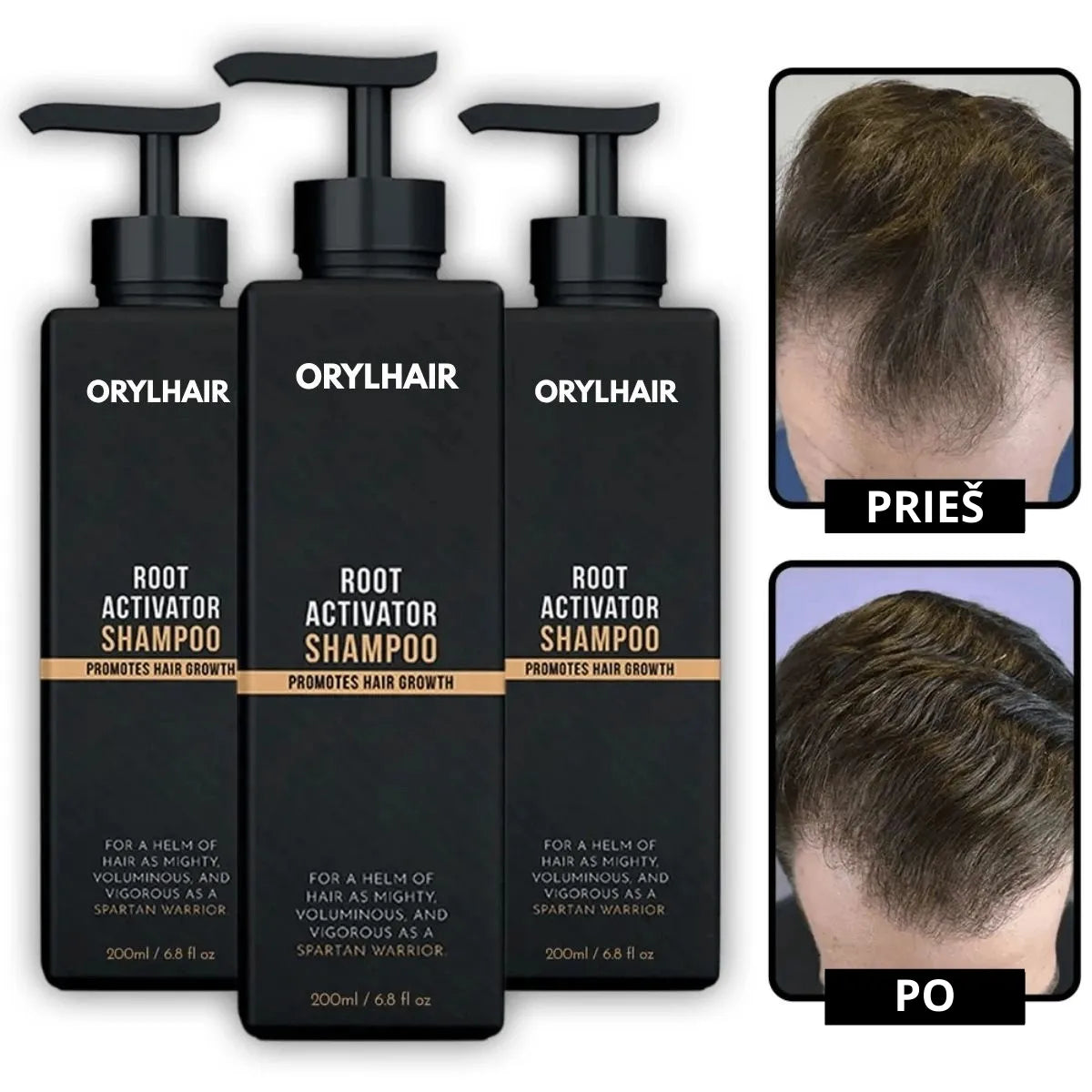 „Orylo™ RootBoost“ plaukų regeneracinis šampūnas
