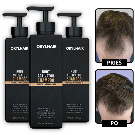 Orylo™ RootBoost“ plaukų regeneracinis šampūnas
