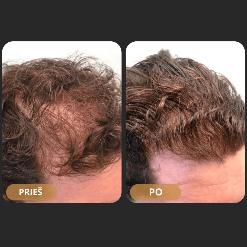 „Orylo™ RootBoost“ plaukų regeneracinis šampūnas