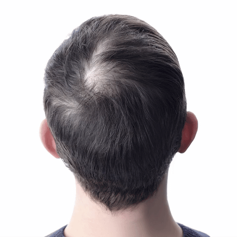 Orylo™ RootBoost“ plaukų regeneracinis šampūnas