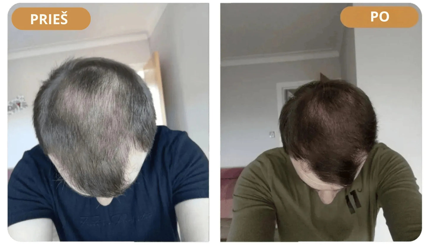Orylo™ RootBoost“ plaukų regeneracinis šampūnas