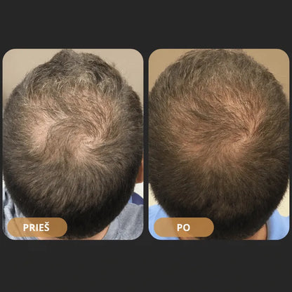 Orylo™ RootBoost“ plaukų regeneracinis šampūnas