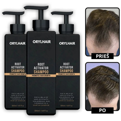 Orylo™ RootBoost“ plaukų regeneracinis šampūnas
