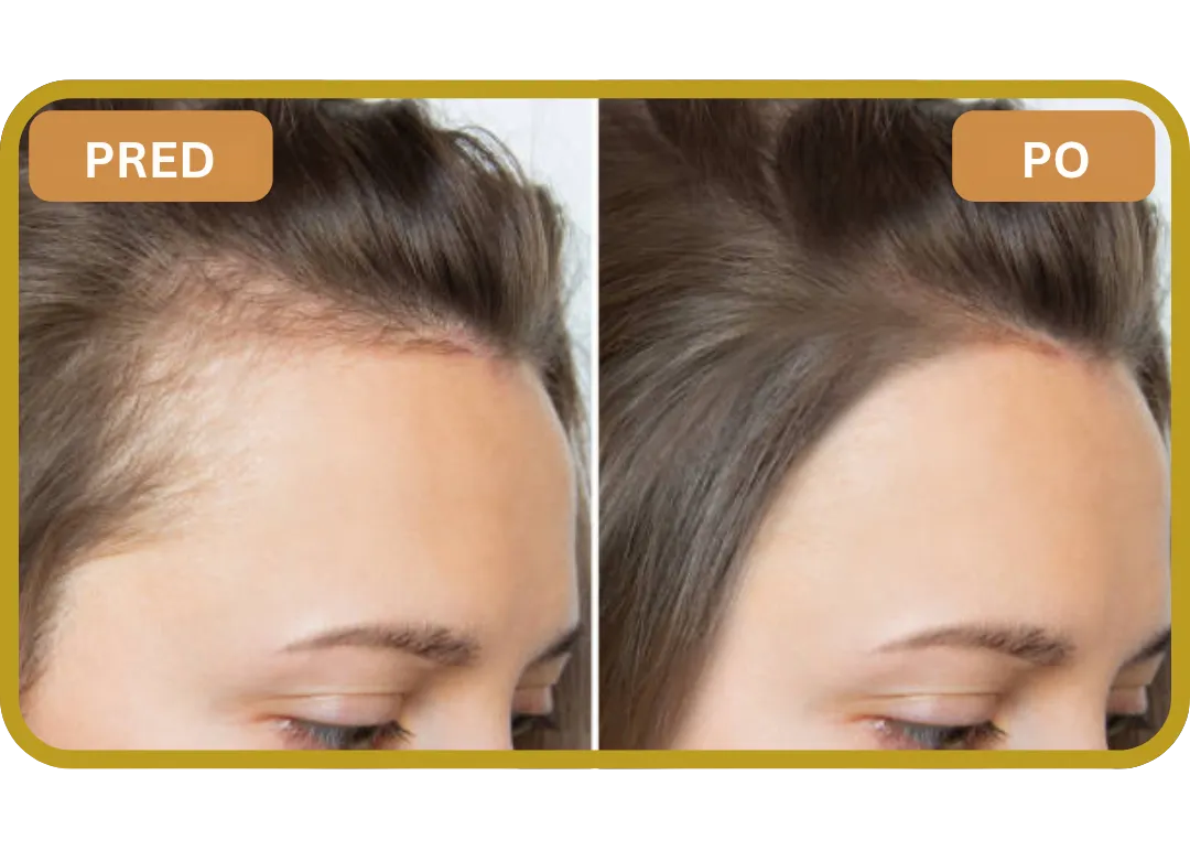 Orylo™ RootBoost Šampón na regeneráciu vlasov v2 (Women)