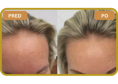 Orylo™ RootBoost Šampón na regeneráciu vlasov v2 (Women)