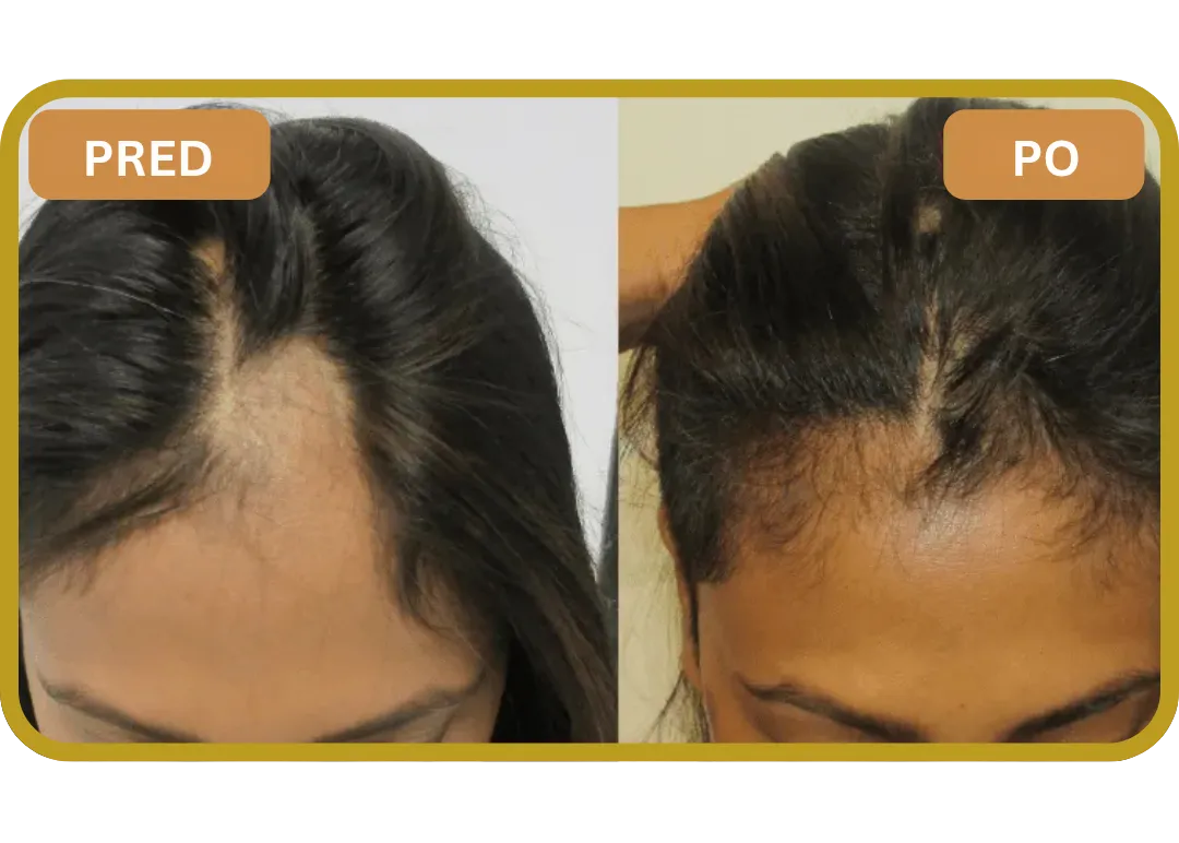 Orylo™ RootBoost Šampón na regeneráciu vlasov v2 (Women)