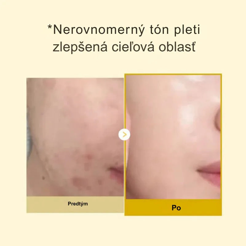 Maska s kyselinou kojovou a kurkumou