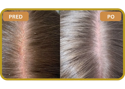 Orylo™ RootBoost Šampón na regeneráciu vlasov v2 (Women)